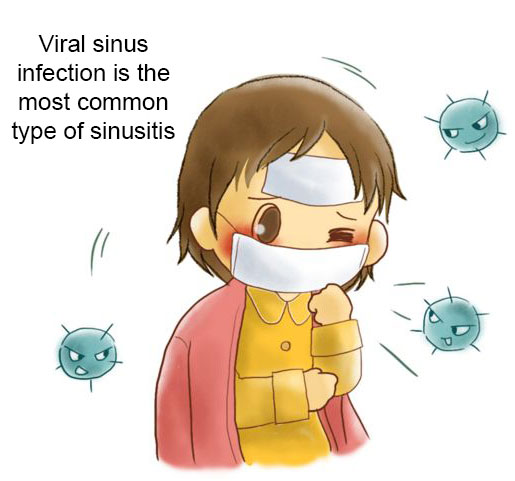Bacterial sinusitis is a complication of viral sinusitis