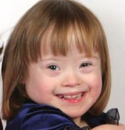 Down Syndrome Down Syndrome