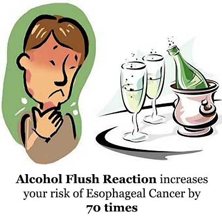 Alcohol Flush Reaction Can Increase Risk of Esophageal Cancer