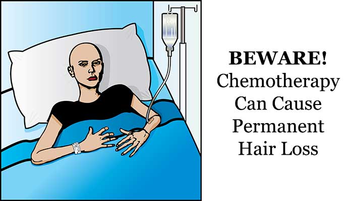 Chemotherapy can result to permanent hair loss