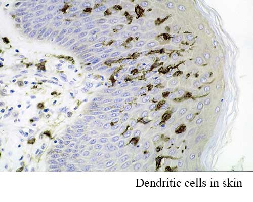 Dendritic Cells in Skin