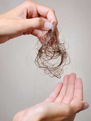 Female Hair Loss