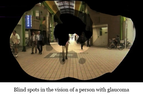 Glaucoma Blind Spots
