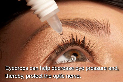 Glaucoma Treatment through the use of Eye Drops