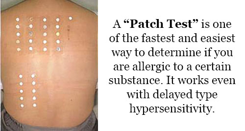 Patch Test