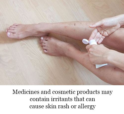 Cosmetic products can cause allergy or skin rash
