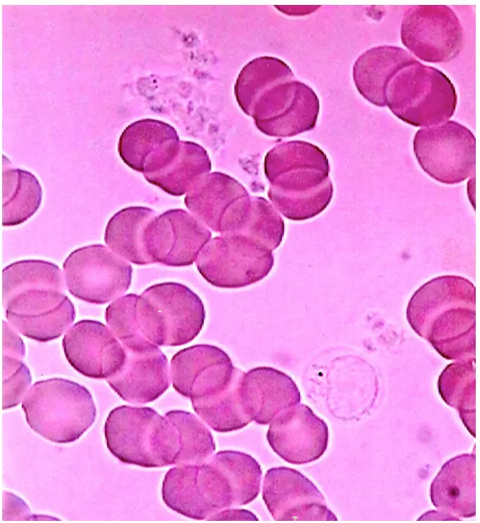 Red blood cells clumping and becoming sticky