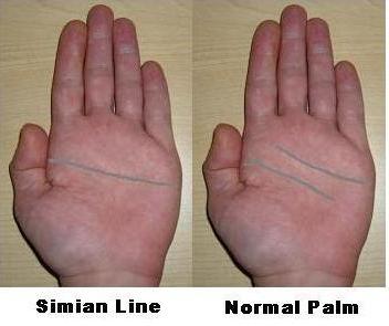 Simian Line