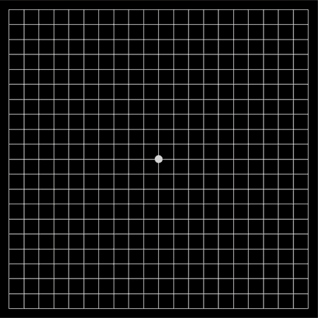 Amsler Grid