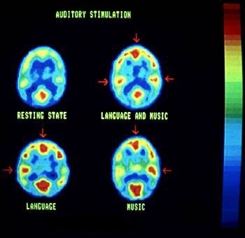 Auditory Stimulation