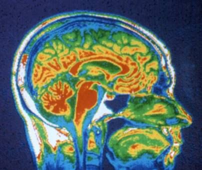 Brain via Magnetic resonance imaging
