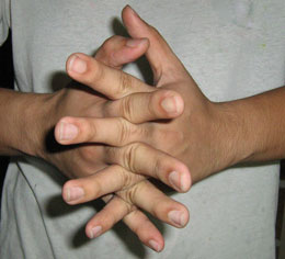 Hands Exercise