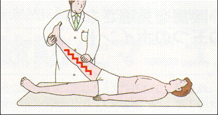 Numbness or Paresthesia