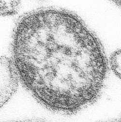 Measles Virus