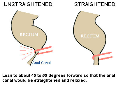 Straightened and Unstraightened Anal Canal