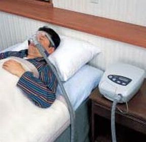 CPAP (Continuous Positive Airway Pressure)