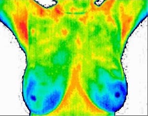Thermogram after eating fresh ginger