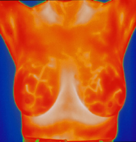 Thermogram after eating dried ginger