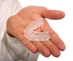 Mouthguards for Bruxism