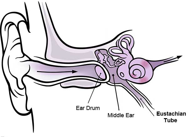 Patulous Eustachian Tube