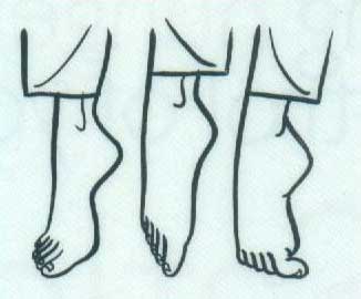 Toe Exercise