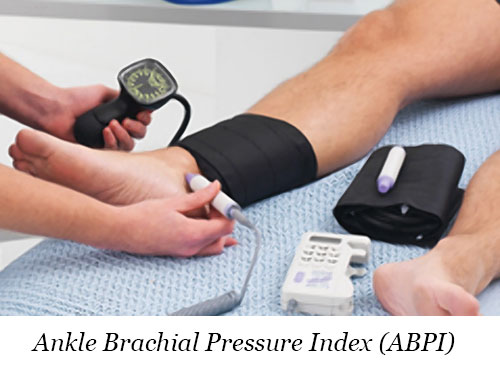 Ankle Brachial Pressure Index (ABPI)