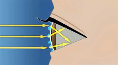 Tears spread unevenly on the eye surface causing blurry vision