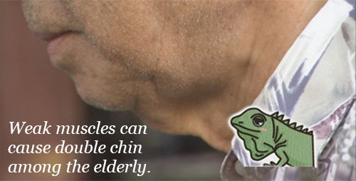 Double chin among the elderly due to weak muscles
