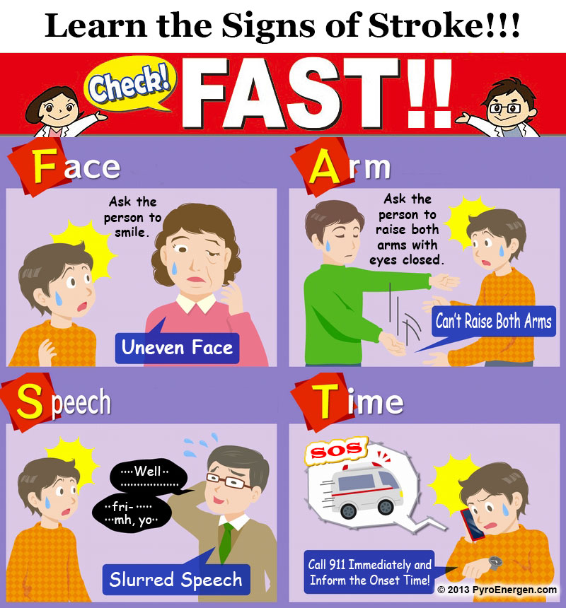 FAST Stroke Protocol