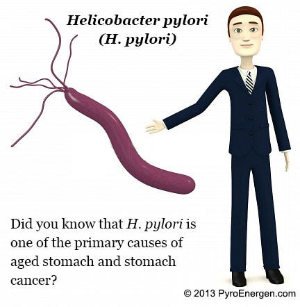 Helicobacter pylori can cause stomach cancer or peptic ulcer