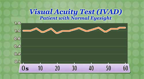 Visual Acuity Test (Person with Normal Eyesight)