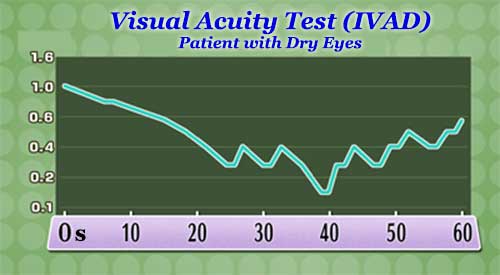 Visual Acuity Test (Person with Dry Eyes)