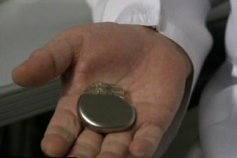 Artificial Heart Pacemaker