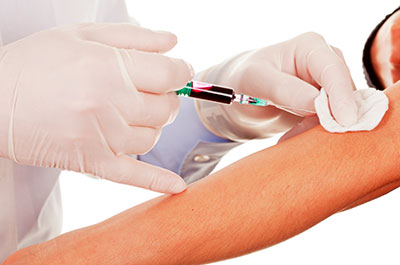 Ferritin Level Blood Test