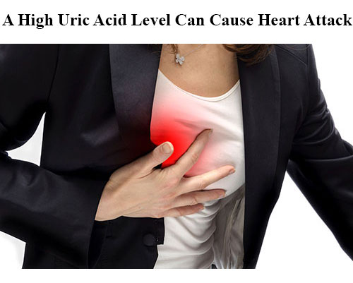High Uric Acid level Can Cause Heart Attack