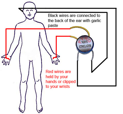 Patch and Nerve Stimulator